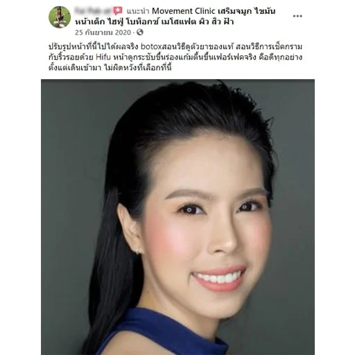 review_botox_01