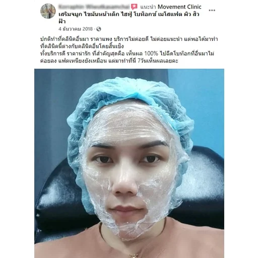 review_botox_03