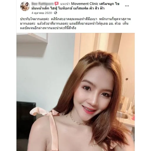 review_botox_04