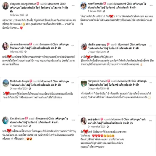 รีวิวจากผู้ใช้บริการ-โบท็อกซ์-8